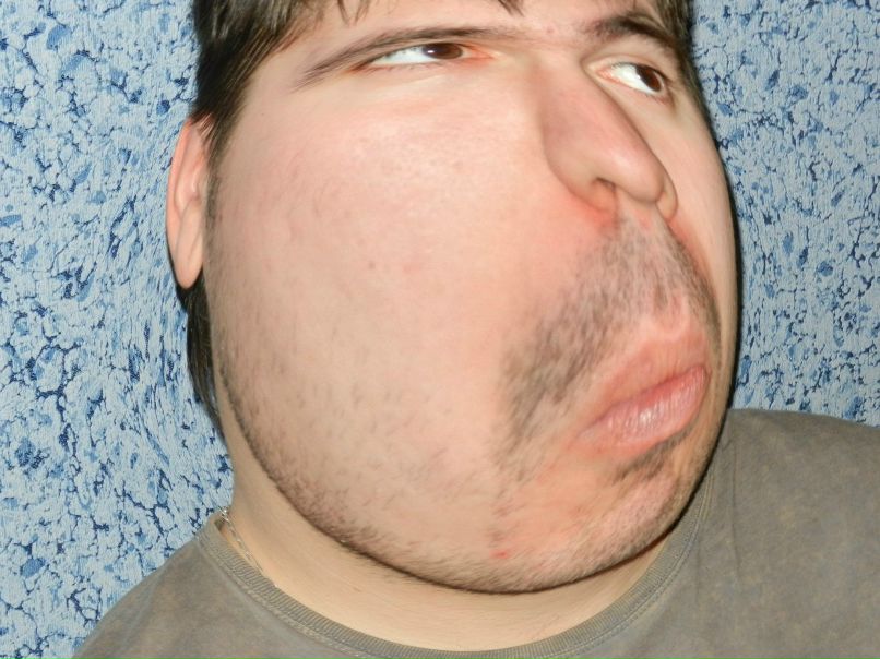 Антон Лопанчук | 